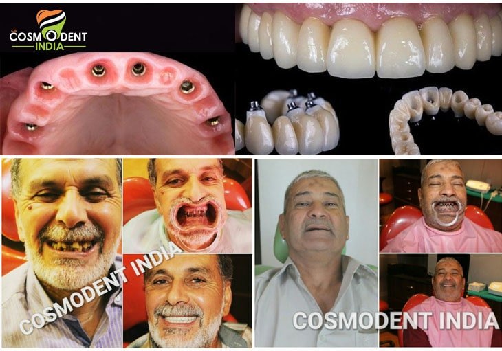 أفضل طبيب زراعة الكل على ستة في الهند أفضل طبيب زراعة الكل على ستة في الهند