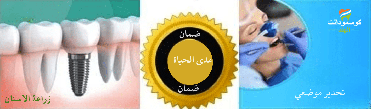 ضمان مدى الحياة لزراعة الأسنان الكاملة ضمان مدى الحياة لزراعة الأسنان الكاملة