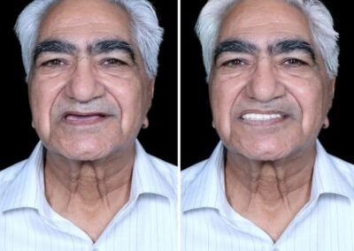أفضل طبيب زراعة الكل على ستة في الهند