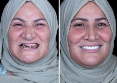 أفضل طبيب زراعة الكل على ستة في الهند