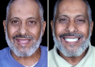 أفضل طبيب زراعة الكل على ستة في الهند