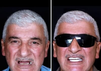 أفضل طبيب زراعة الكل على ستة في الهند