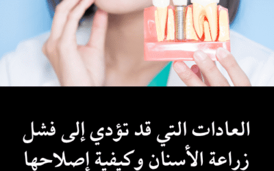 أربعة (٤) عادات قد تؤدي الى فشل زراعة الاسنان وكيفية اصلاحها